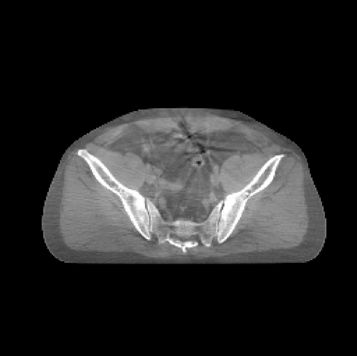 CycleDPM project hero image