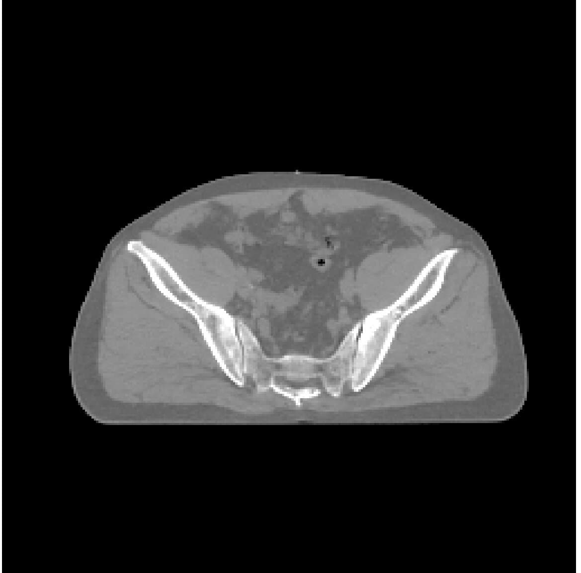 Synthesized CT output